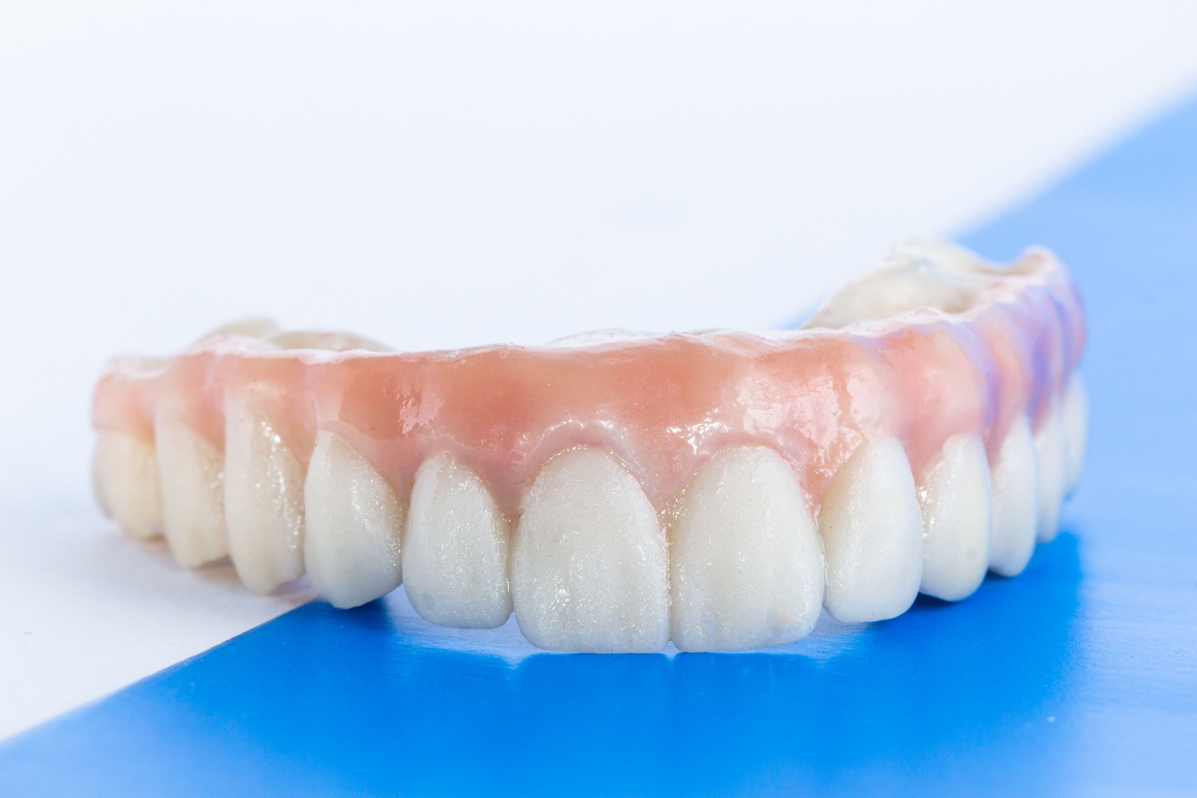 Puentes indirectos sobre implantes en zirconia Dental