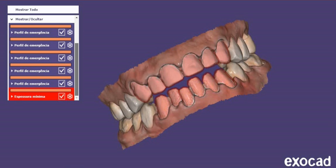 qué es el sistema cad cam dental