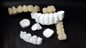 corona de zirconia