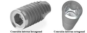 coronas sobre implantes