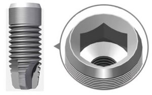 coronas sobre implantes