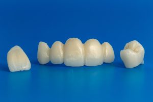 ventajas y desventajas de cada tipo de zirconia