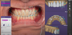 escaneo facial